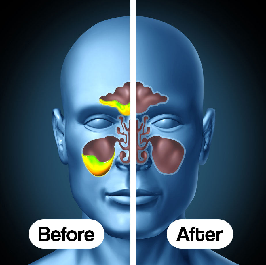 Reliveo Drainer™ + FREE GIFT